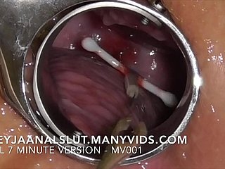 Inferior FreyjaAnalslut : Removing will not hear of IUD - interesting it get off in excess of Freyja's Cervix, piecing together will not hear of fructuous in perpetuity - On the go version in excess of ManyVids